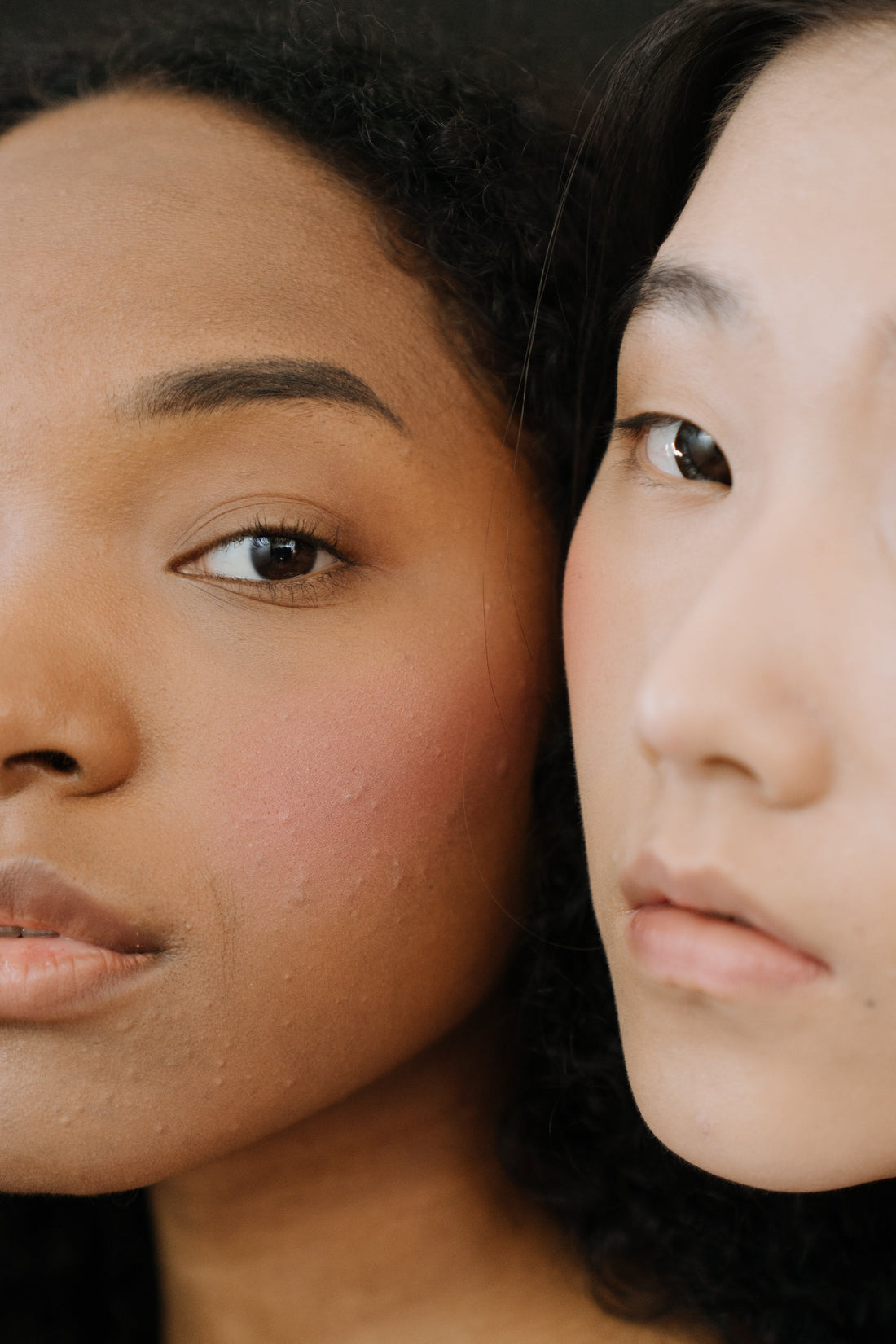 Tout Savoir sur l'Acné : Comment nos Savons Solides Peuvent Transformer Votre Routine de Soin du Visage - Pureté Solide